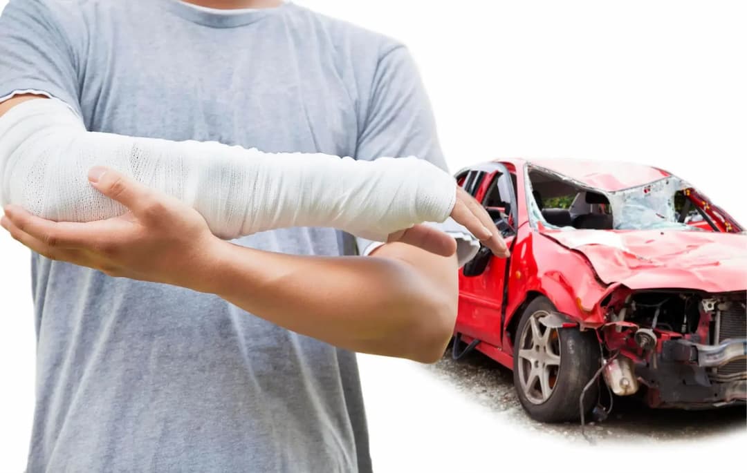Zdjęcie przedstawia osobę ze złamaną ręką stojącą obok rozbitego auta.